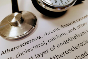 Atherosclerosis